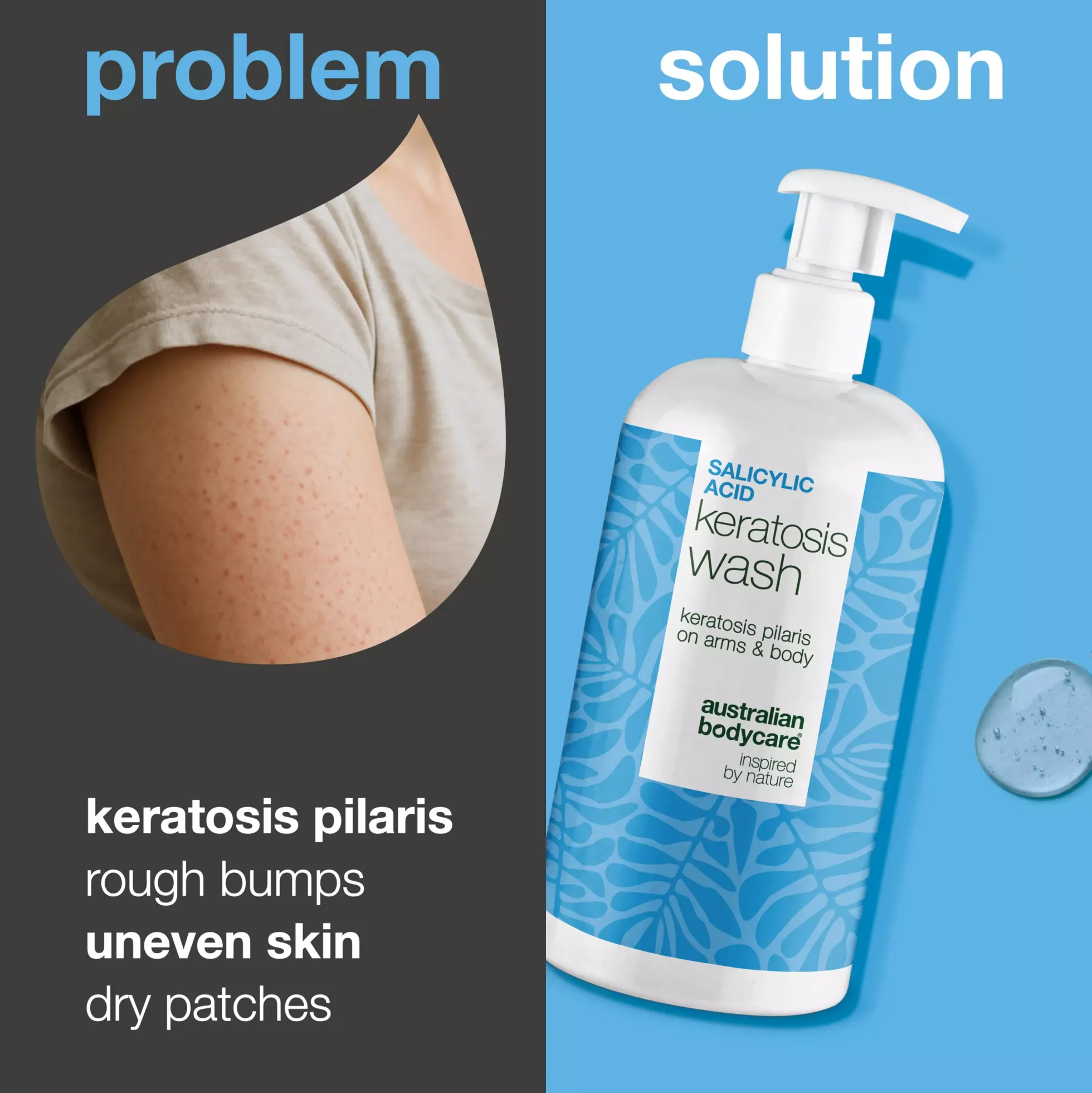 Australian Bodycare Salicylic Acid Keratosis Wash 500 ml