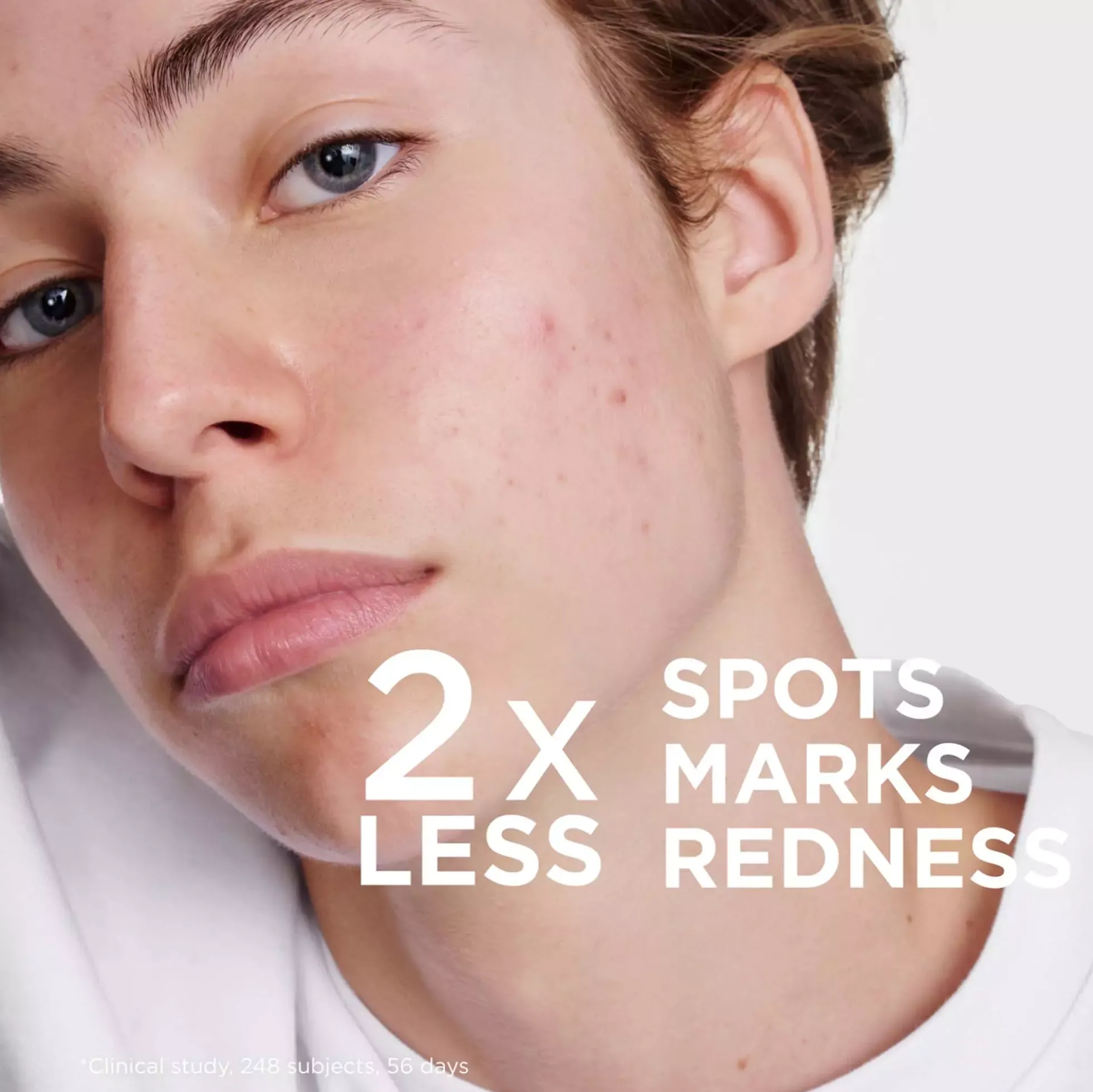 BiodermaSébium Kerato+ 30 ml