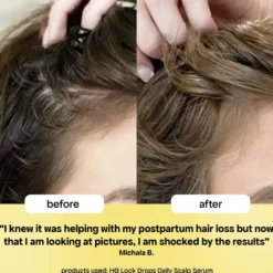 Bondi Boost HG Lock Drops For Thinning Hair 30 ml