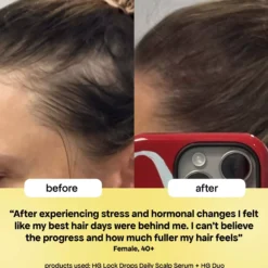 Bondi Boost HG Lock Drops For Thinning Hair 30 ml