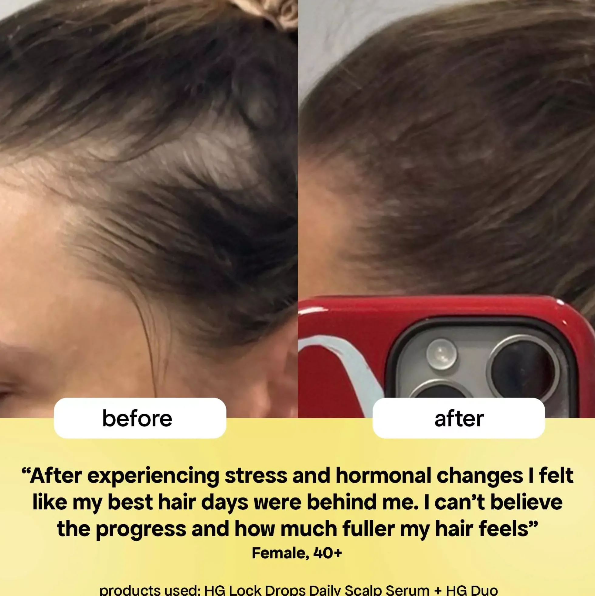 Bondi Boost HG Lock Drops For Thinning Hair 30 ml