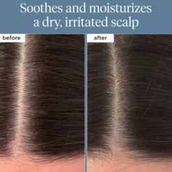 BriogeoScalp Revival™ Rosemary Pre-Wash Oil