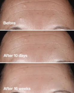 CliniqueSmart Clinical Repair Wrinkle Correcting Serum 75 ml