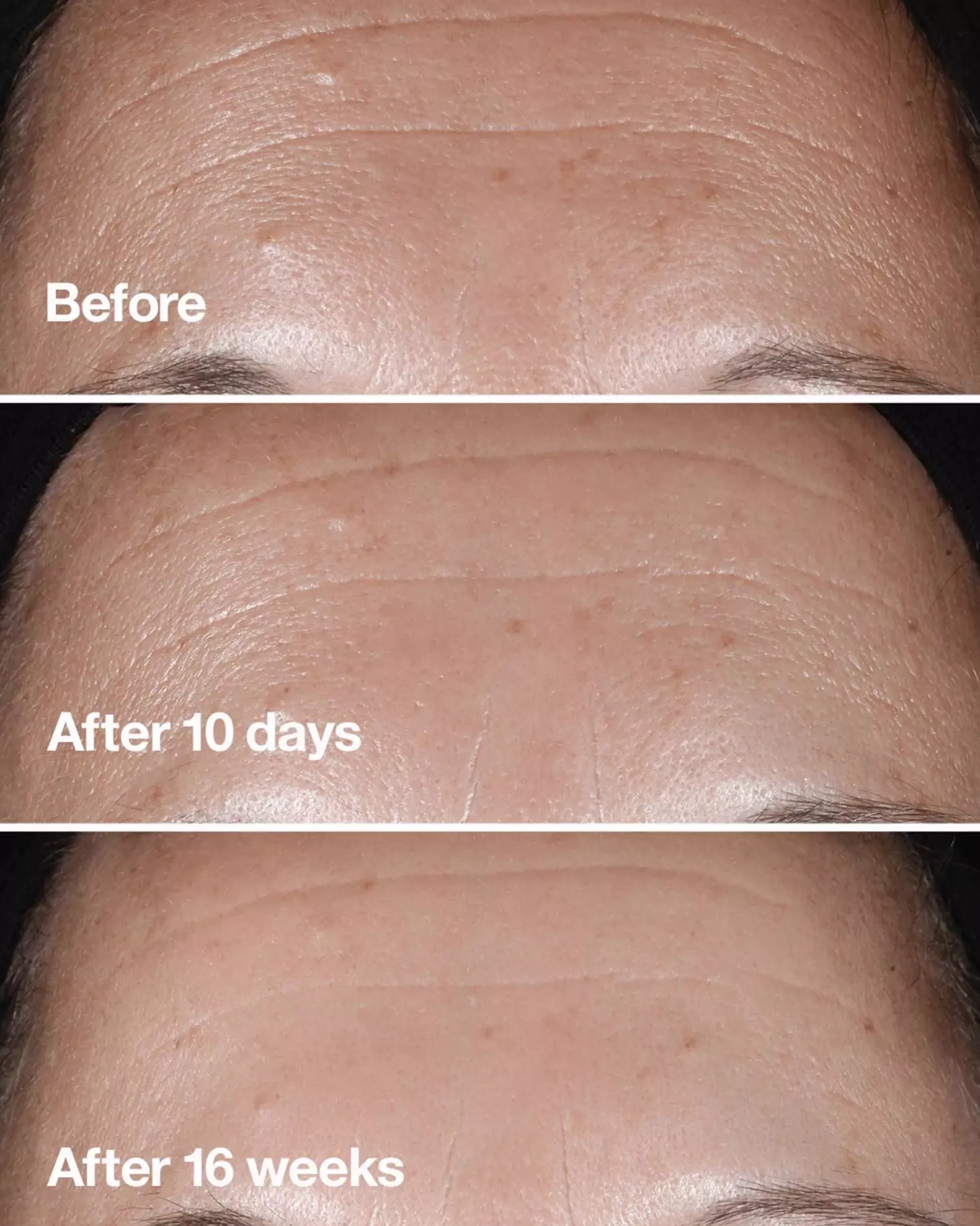 CliniqueSmart Clinical Repair Wrinkle Correcting Serum 75 ml