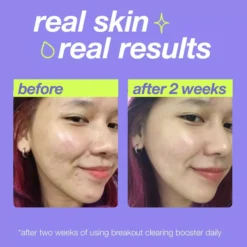 DermalogicaClear Start Breakout Clearing Booster 30 ml