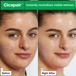 Dr.Jart+Cicapair Tiger Grass Color Correcting Treatment 30 ml