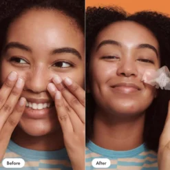 Hero Nose Patch