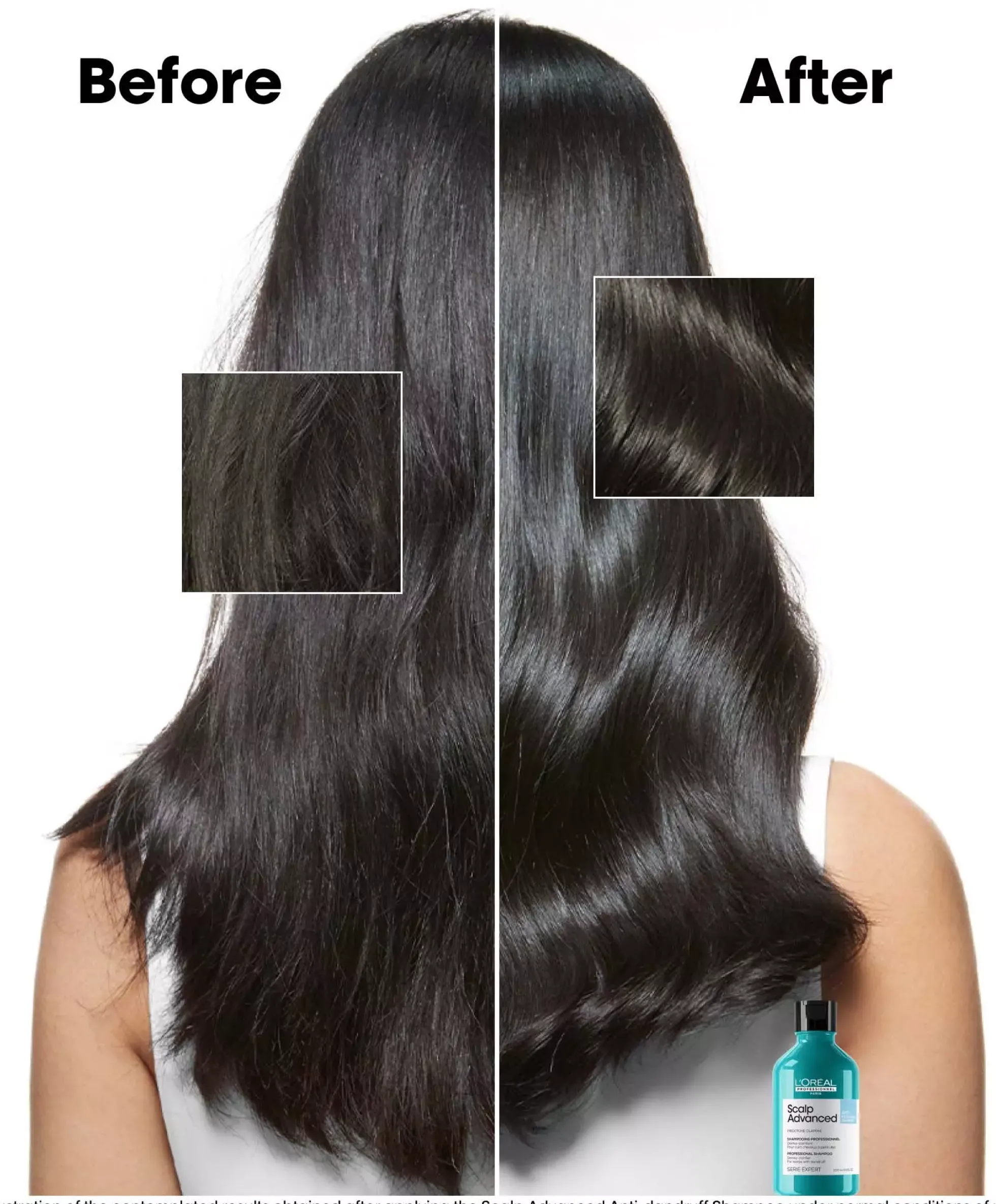 L'Oréal ProfessionnelScalp Advanced Professional Shampoo 300 ml