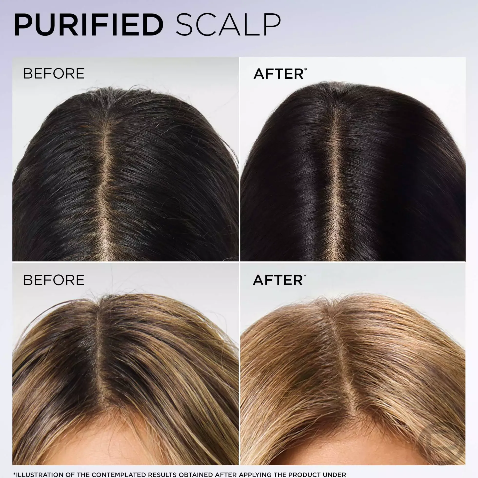 Loreal ParisElvital Hyaluron Pure Conditioner 300 ml