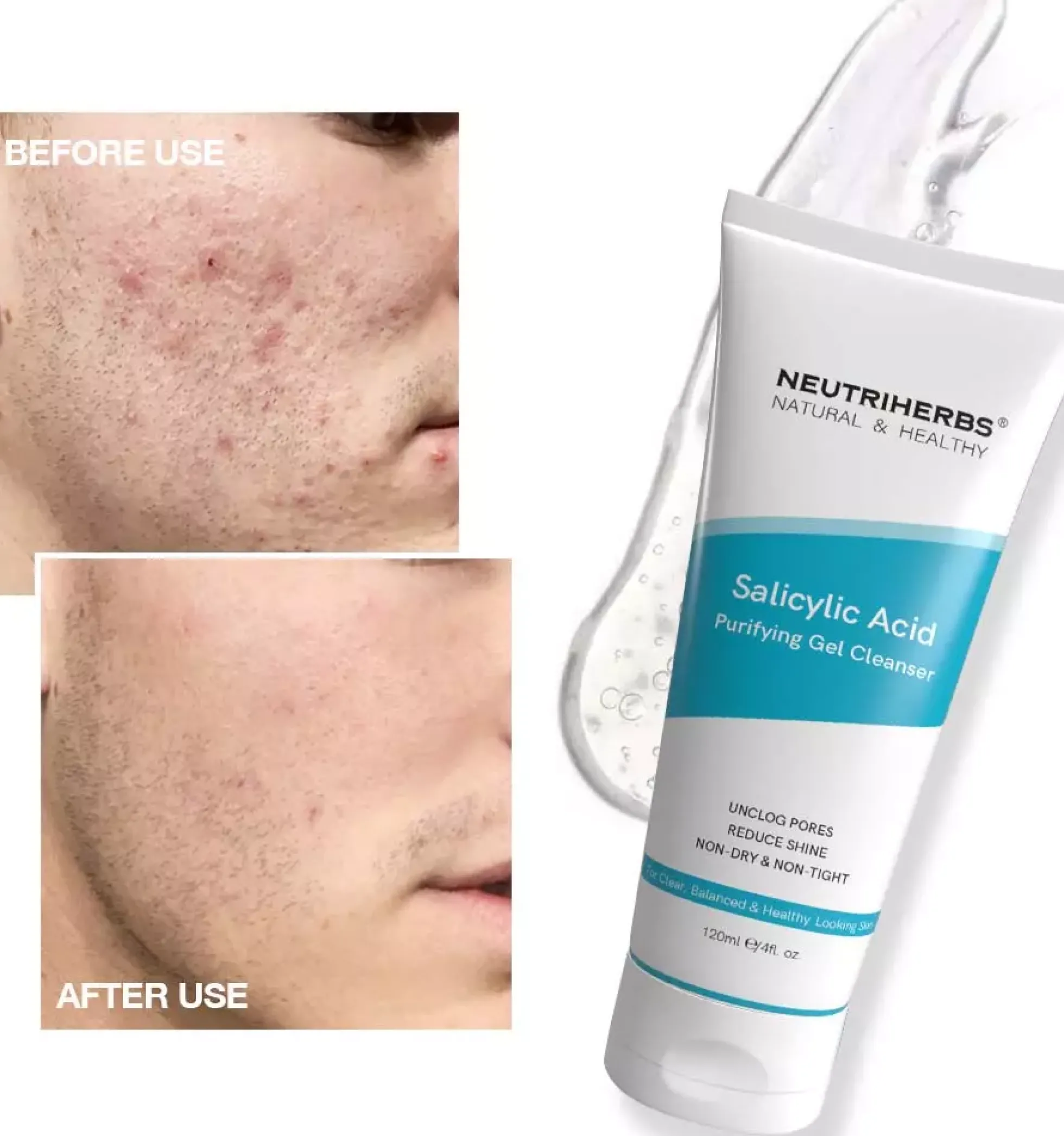 Neutriherbs Salicylic Acid Purifying Gel Cleanser 120 ml