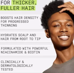 NioxinSystem 2 Conditioner for Thinning Hair 300 ml