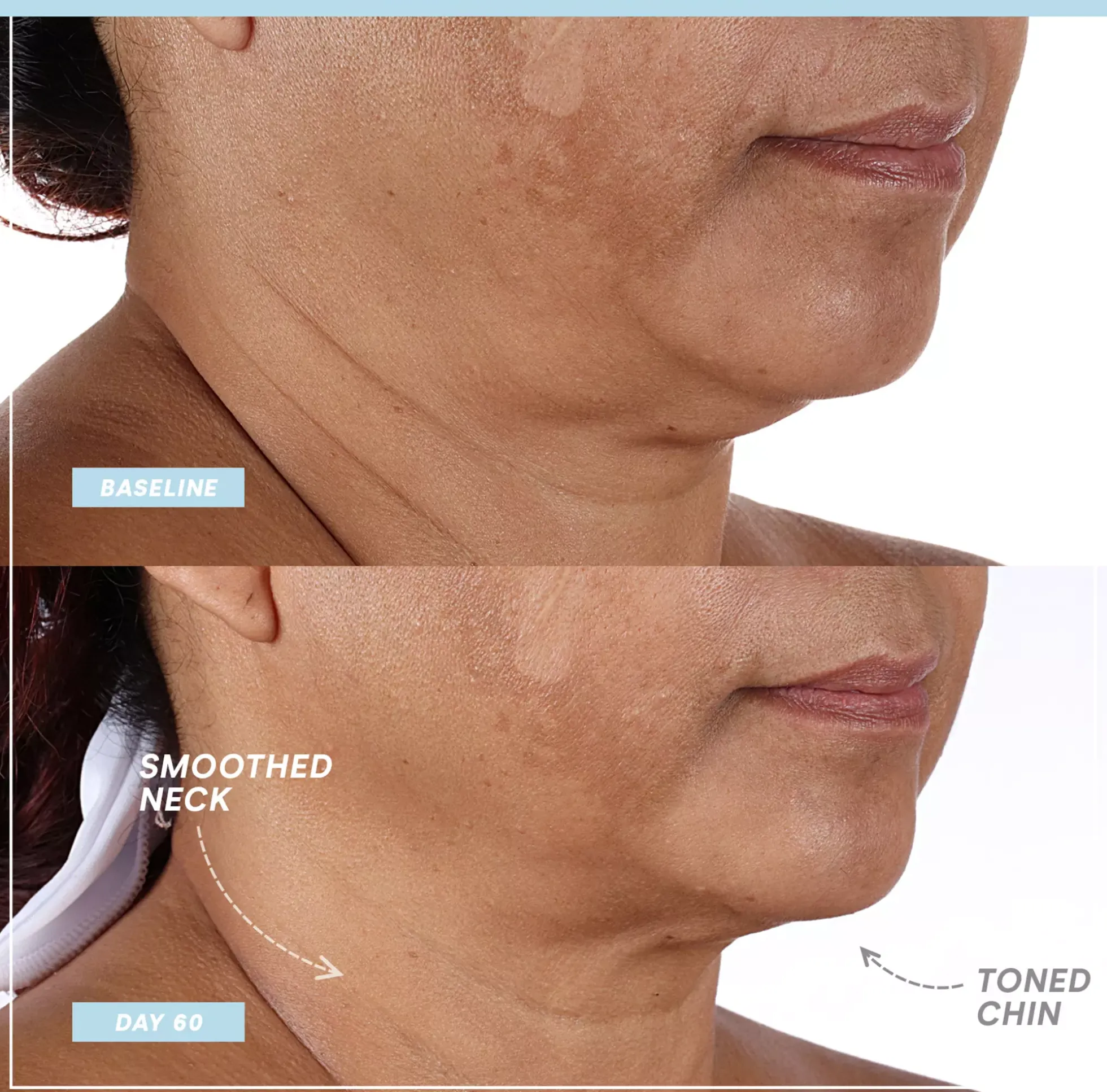 NuFACE Mini+ Smart Petit Facial Toning Kit Sandy Rose
