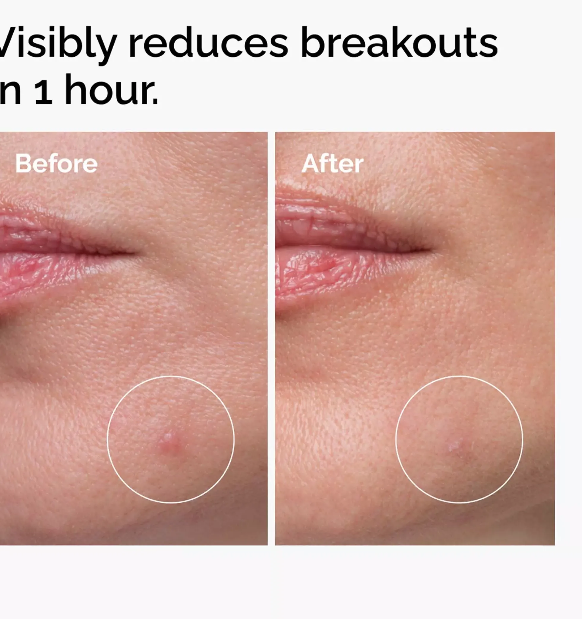 The Ordinary Sulfur 10% Powder-to-Cream Concentrate 5 g